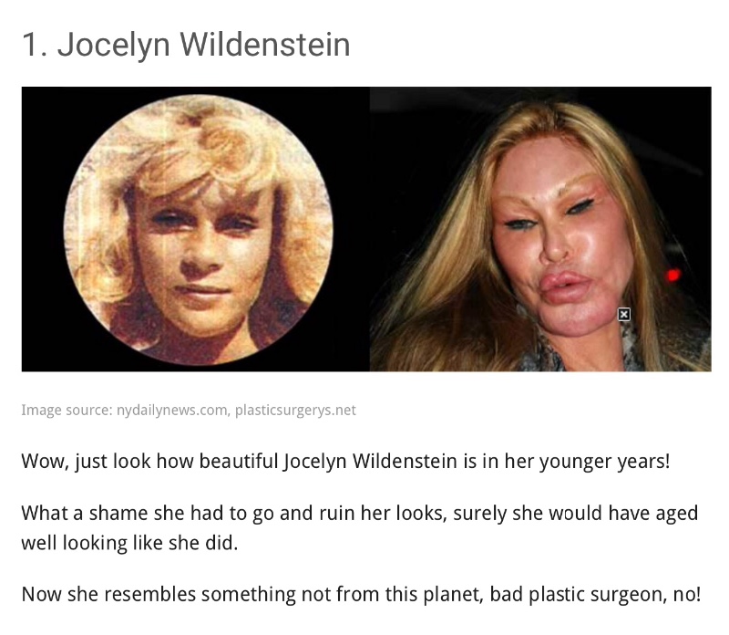 Yikes....13 shocking celebrity plastic surgery disasters
