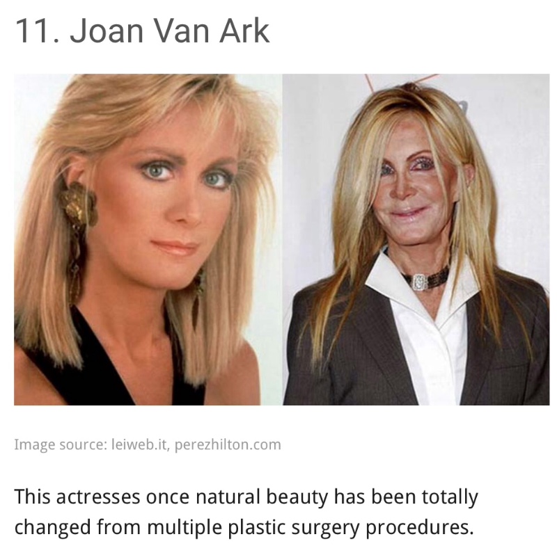 Yikes....13 shocking celebrity plastic surgery disasters