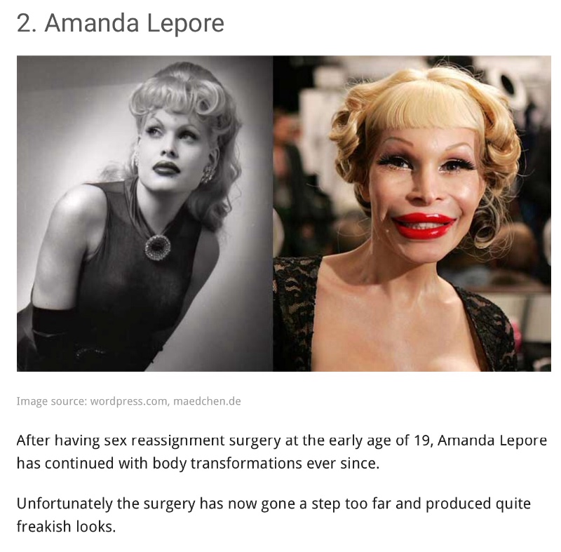 Yikes....13 shocking celebrity plastic surgery disasters