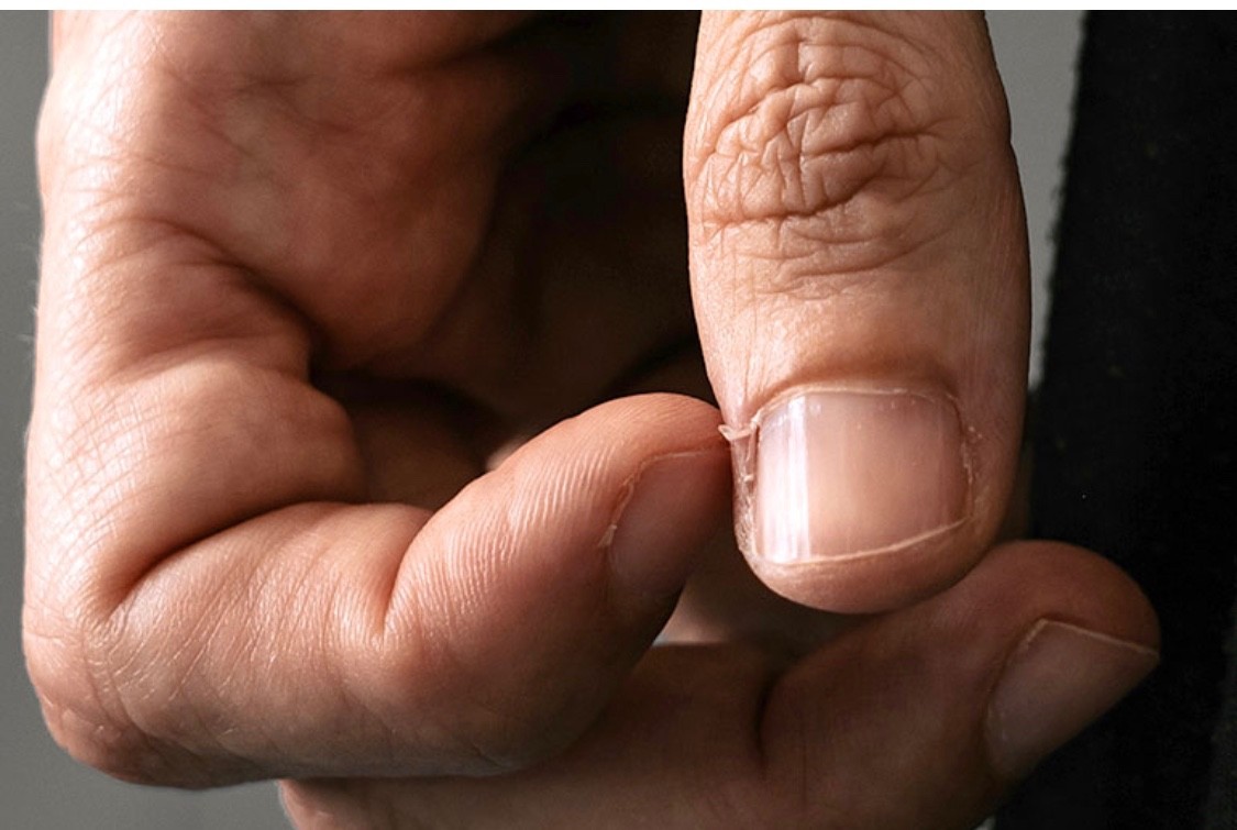 I was wondering why broken or torn cuticle is called a hangnail.
